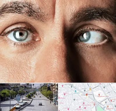 فوق تخصص استرابیسم در خیابان زند شیراز