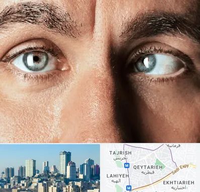 فوق تخصص استرابیسم در قیطریه 