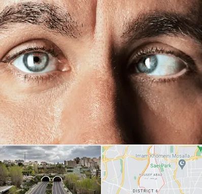 فوق تخصص استرابیسم در یوسف آباد 