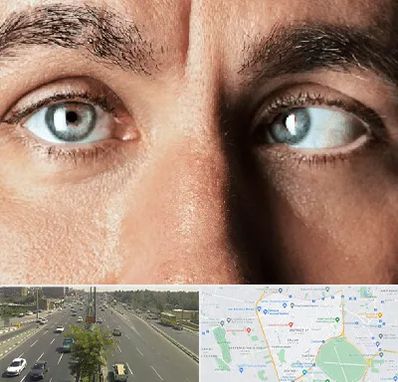 فوق تخصص استرابیسم در منطقه 17 تهران 