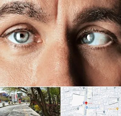 فوق تخصص استرابیسم در خیابان توحید اصفهان