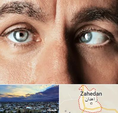 فوق تخصص استرابیسم در زاهدان