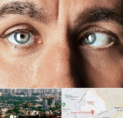 فوق تخصص استرابیسم در عظیمیه کرج 