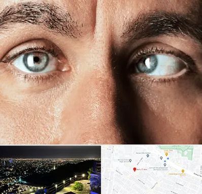 فوق تخصص استرابیسم در هفت تیر مشهد 