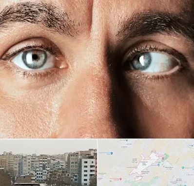 فوق تخصص استرابیسم در محمد شهر کرج 