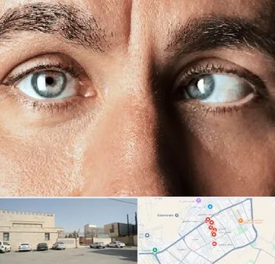 فوق تخصص استرابیسم در نواب اسلامشهر