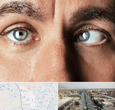 فوق تخصص استرابیسم در حصارک کرج