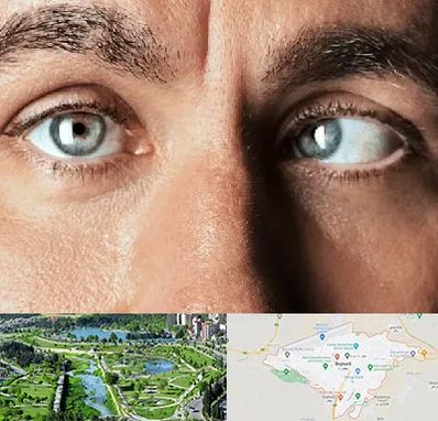 فوق تخصص استرابیسم در بجنورد