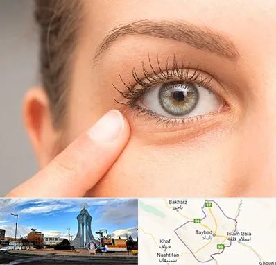 جراح پف چشم در تایباد