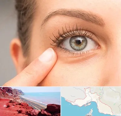 جراح پف چشم در هرمزگان