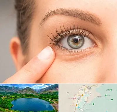 جراح پف چشم در رودبار