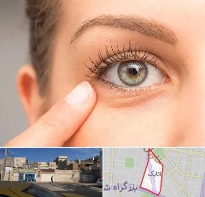 جراح پف چشم در اتابک