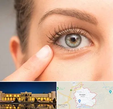 جراح پف چشم در برازجان