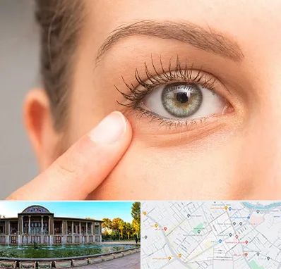 جراح پف چشم در عفیف آباد شیراز