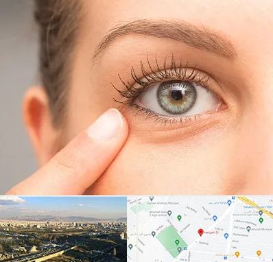 جراح پف چشم در هنگام 