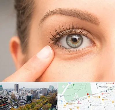 جراح پف چشم در بلوار کشاورز 