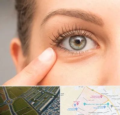 جراح پف چشم در الهیه مشهد