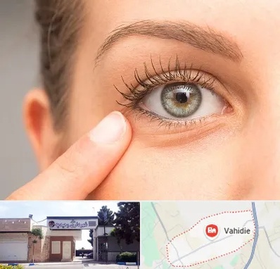 جراح پف چشم در وحیدیه شهریار