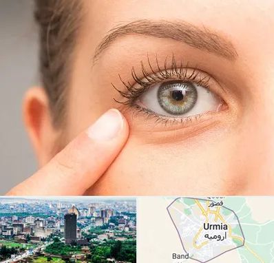 جراح پف چشم در ارومیه