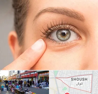 جراح پف چشم در شوش