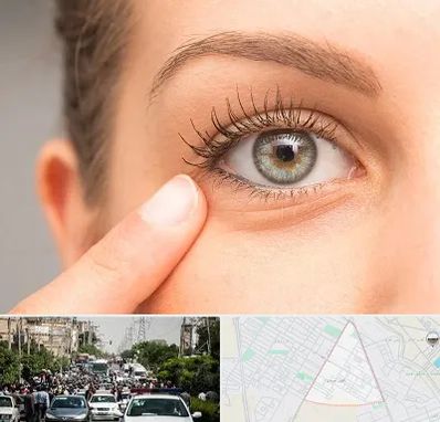 جراح پف چشم در سیدی مشهد