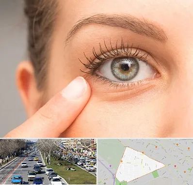 جراح پف چشم در احمدآباد مشهد 