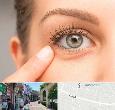 جراح پف چشم در خیابان قزوین