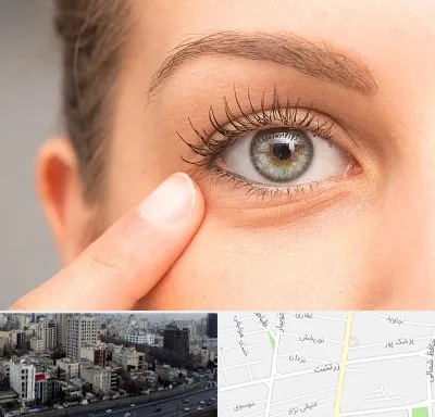 جراح پف چشم در زرتشت
