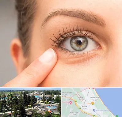 جراح پف چشم در رودسر