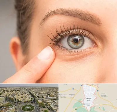 جراح پف چشم در قزوین