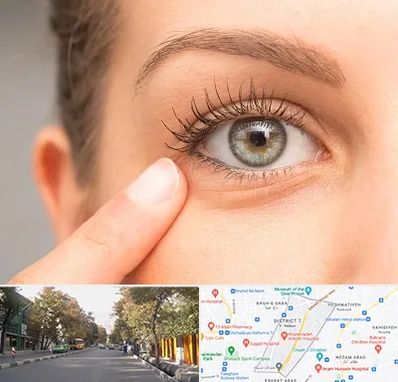 جراح پف چشم در شریعتی 