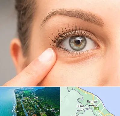 جراح پف چشم در رامسر