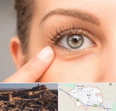 جراح پف چشم در بم