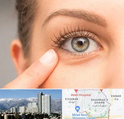 جراح پف چشم در شهرک غرب 
