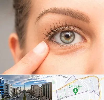 جراح پف چشم در سعادت آباد 