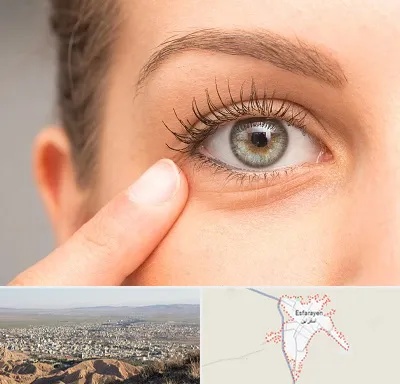 جراح پف چشم در اسفراین