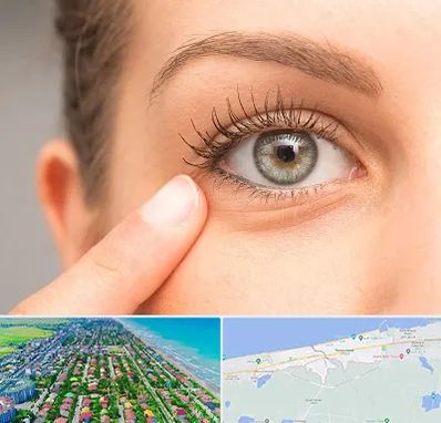 جراح پف چشم در فریدونکنار