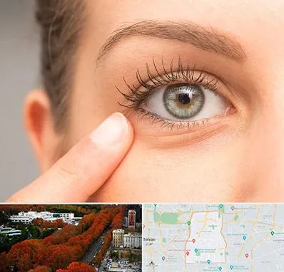 جراح پف چشم در منطقه 6 تهران 