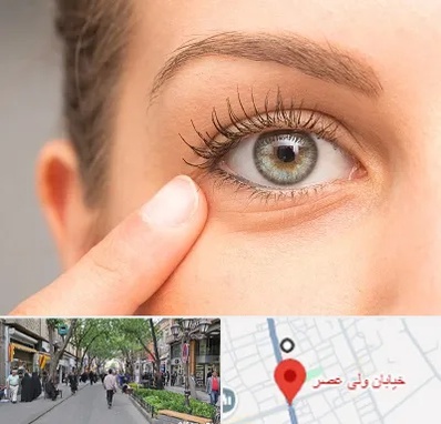 جراح پف چشم در ولیعصر شهریار