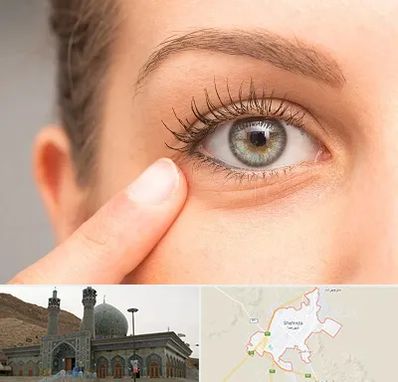 جراح پف چشم در شهرضا