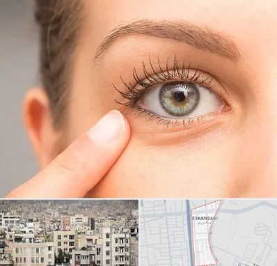جراح پف چشم در اسکندری