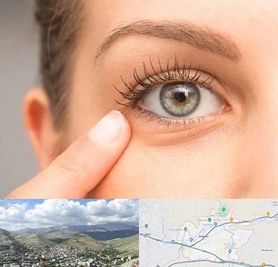 جراح پف چشم در رودهن