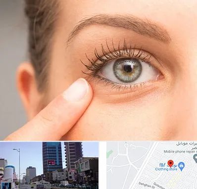 جراح پف چشم در چهارراه طالقانی کرج