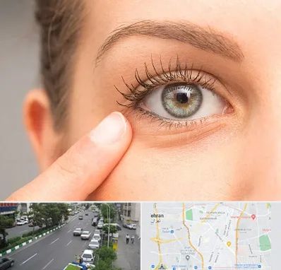 جراح پف چشم در ستارخان 