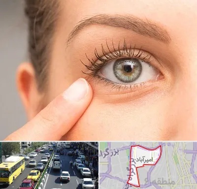 جراح پف چشم در امیرآباد