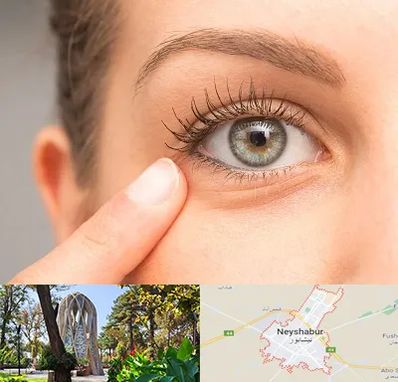 جراح پف چشم در نیشابور