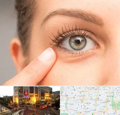 جراح پف چشم در جنت آباد تهران 