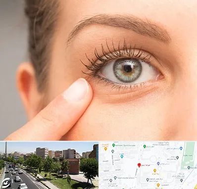 جراح پف چشم در شهرک آزمایش 