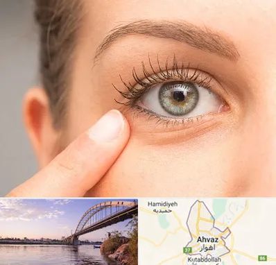جراح پف چشم در اهواز