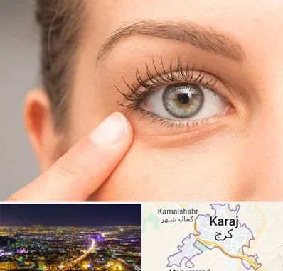 جراح پف چشم در کرج